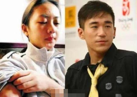 童瑶|张默当年打童瑶下手真重啊，脸都肿了，眼球充血，腿和手都是淤青