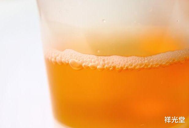 肝癌|肝癌最会“伪装”,医生:身体出现4个表现,趁早去查一查肝功!