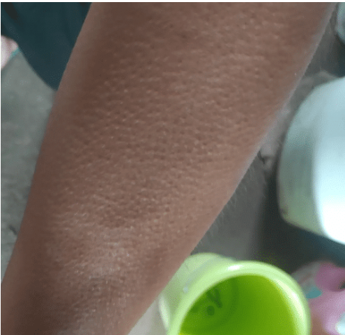 壁虎|“买了个壁虎,为啥越长越大了...”哈哈哈...基因变异?