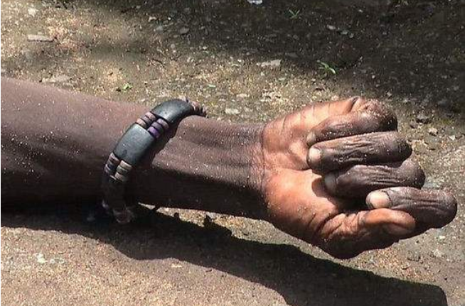 『埃博拉疫情』埃博拉病毒有多恐怖？艾滋病都被踩在脚下，连科学家也束手无策