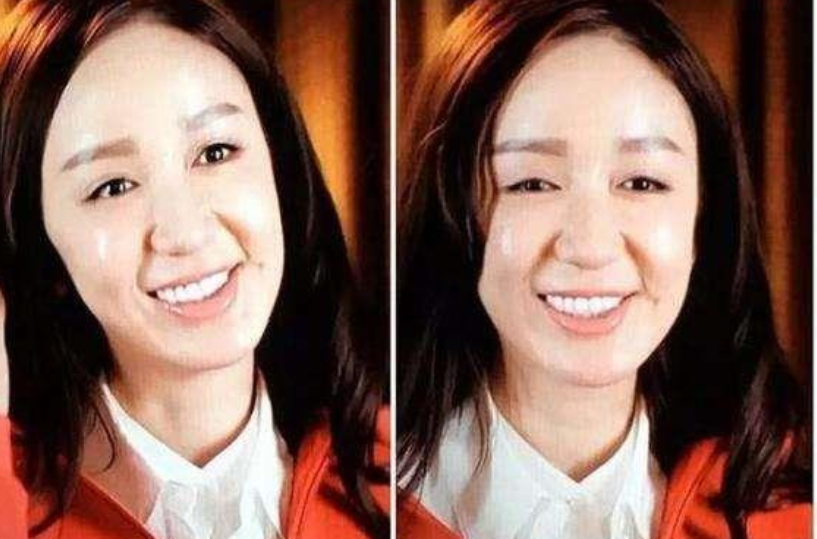 整容|她31岁脸就“崩”了？坚决不承认整容，今却满脸硅胶感垮成“假人”