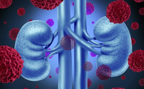 「尿毒症」尿毒症出现前，身体会有这几个征兆，千万别大意！