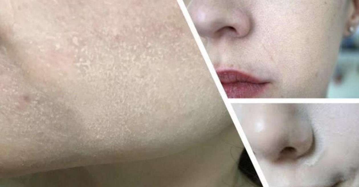 底妆|有种“尴尬”叫女星卡粉，外媒生图下妆容斑驳，细纹卡粉一目了然