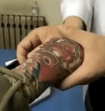 【】男子到医院打吊瓶，护士都不知道扎那里，网友说自作孽不可活！