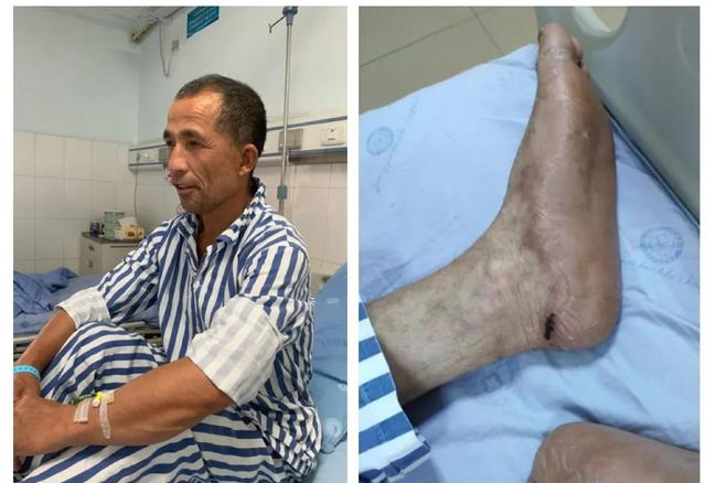 「怪你过分美丽」隧洞求生的176小时：用电线做吸管，电瓶接灯泡，工人七日未进食，出去想吃碗醪糟汤圆粉子