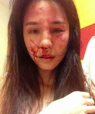 『家暴』男子家暴，妻子致肝破裂，被判有期徒刑三年！