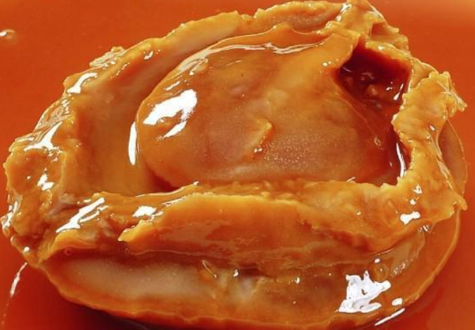 尿酸|医生告诫:这4物是“升酸王”,不想双肾报废,再馋也要管住嘴