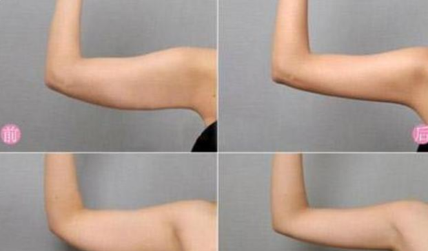 运动|137斤胖妈减肥失败3次，最后靠3大招怒减32斤，她的方法值得学习