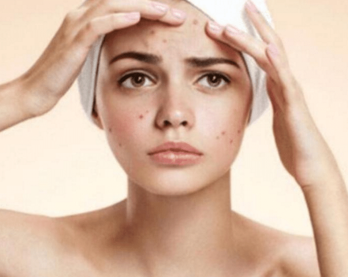 李佳琦直播5秒钟,狂卖了200万支的洗面奶,网友:7秒黑头闭口没了