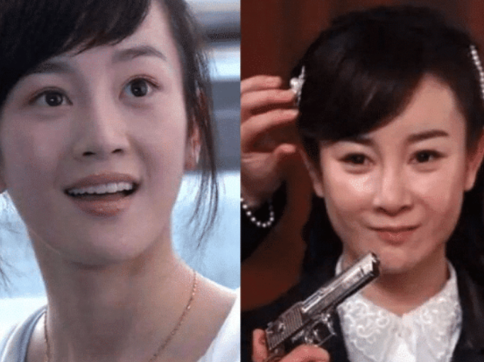 整容 4位整容失败的女星,第2位堪比毁容,最后1位整成“巫婆”