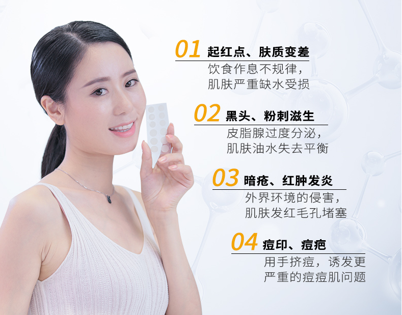 王源|王源脸上的痘痘越发严重，从脸颊长到耳根，快本的美颜都救不了！