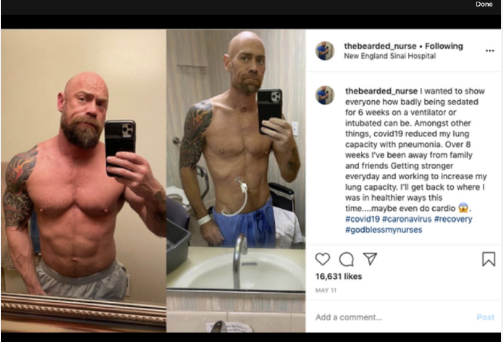 #新型冠状病毒肺炎#截止至5月20日，新冠肺炎的后遗症有多可怕？体壮如牛到瘦骨嶙峋