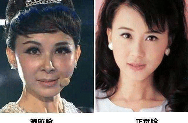 整容失败的五位女星,第一个成了"反面教材",最后一个真的太可惜