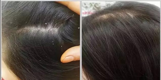 洗发水|央视曝光:这4类洗发水“建议”不要买,虽然销量高却存在不少问题