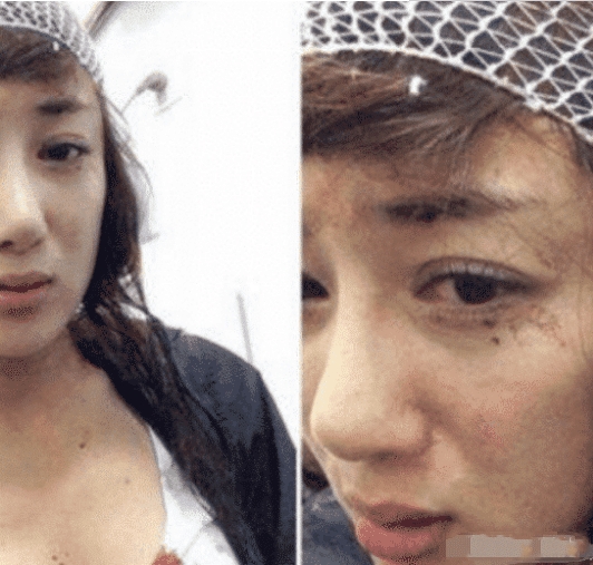 「整容」她被称“古装第一美人”， 因被狗咬毁容， 如今整容三次却物是人非