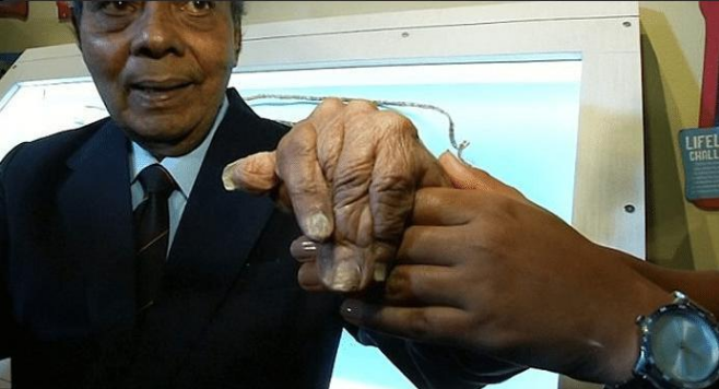 印度老人將指甲留44年，剪掉捐博物館後，他的手指產生瞭大變化-圖5