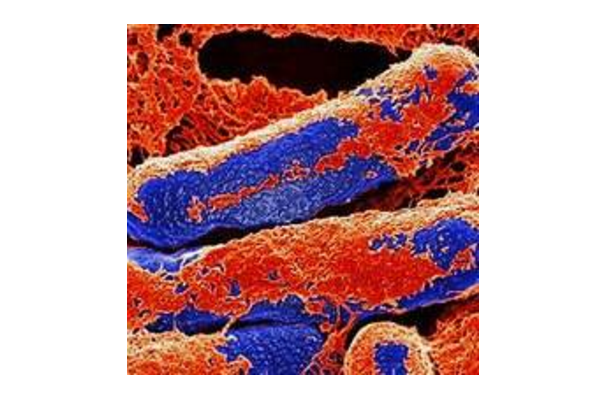 尼古丁@世界十大最毒东西排行榜 蛇毒仅列第六，第一毒性可怕