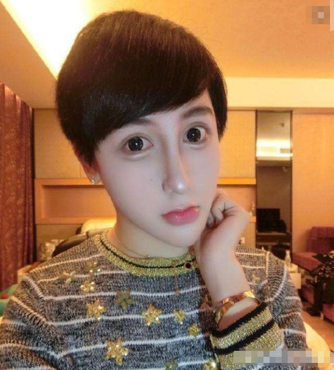 整容|那个13岁开始整容，3年整容60多次的网红女孩，如今怎么样了？