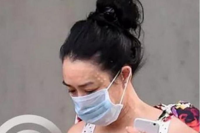 钟丽缇■49岁钟丽缇素颜照曝光，满脸都是打针痕迹，张伦硕每天怎么面对的？