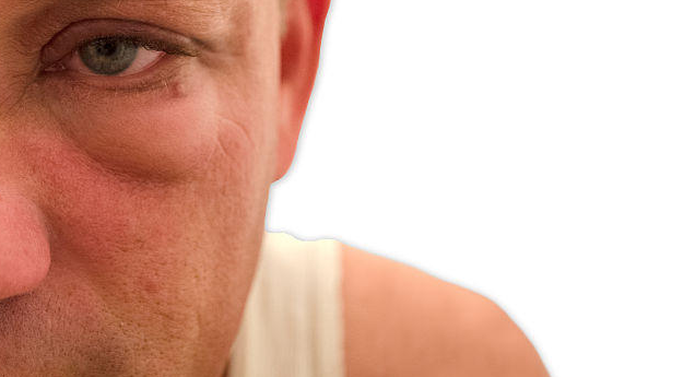 肾病:晨起身上有这三种表现,可能是肾病在靠近!中2个以上最好去医院