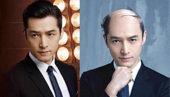 【白萝卜】假如你30岁成了地中海发型，从没想到居然有这么多好处