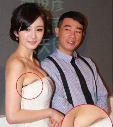 娱乐圈|没有这些“假物”撑着，娱乐圈将会少一半俊男美女，这真不是吹牛