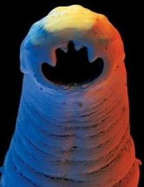 「」它们肆虐全球，能致残、致命，全球受感染人口超12亿，是人类生存的大敌之一