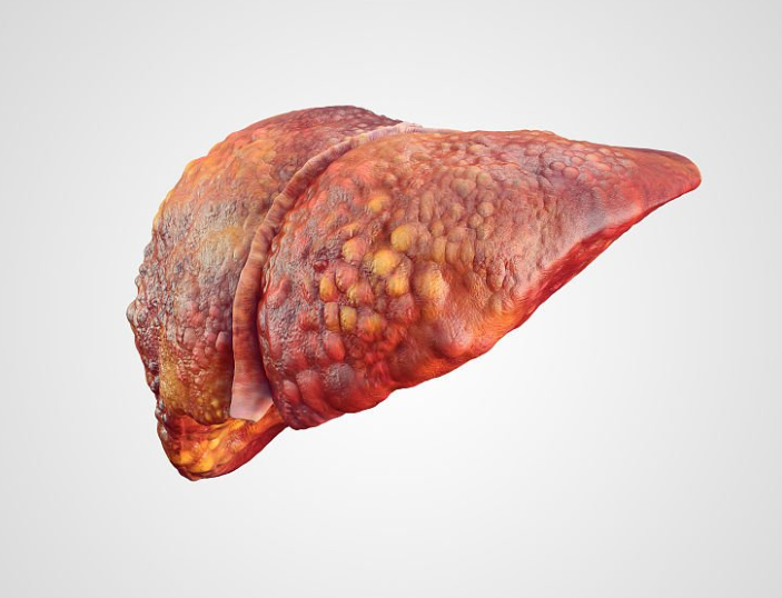 肝脏@肝不好的人,每天晨起做好“3件事”,肝想不好都难