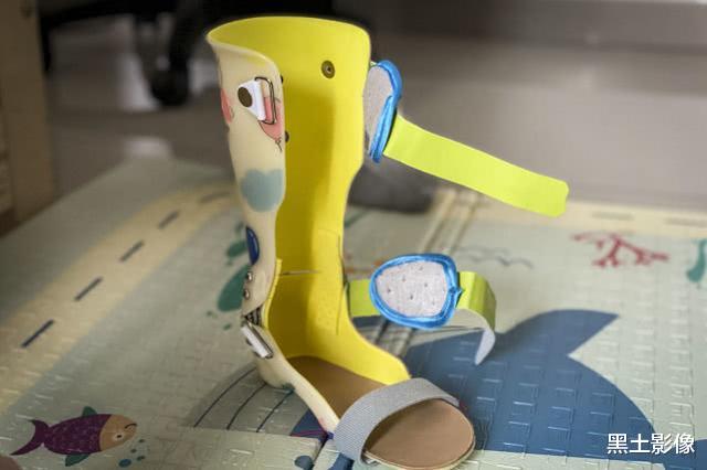 押金@5岁男孩突然不会走路一查患有重症，接下来医生说的话就更可怕了