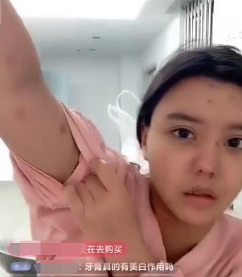 岳云鹏|韩安冉精神病院内再开播，百万整容脸已不成样子，恳请粉丝买面膜