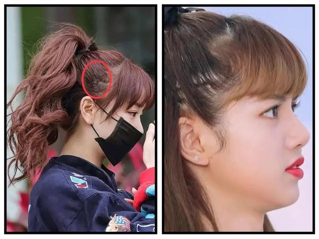 鞠婧祎■鞠婧祎是连头皮都整了?看到她头发缝那一刻,怀疑眼睛