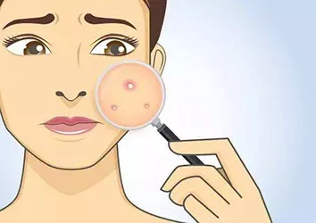 【程潇】夏日肌肤保养你应该知道的东西