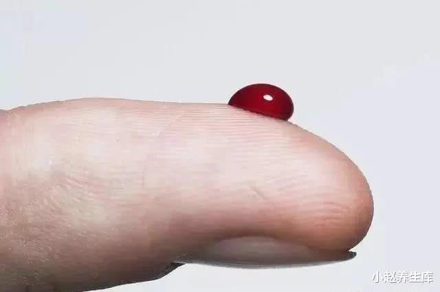 「长寿」血糖高不高，看这4个地方早知道！降血糖：戒掉三习，做好5件事！