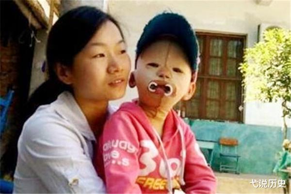 弋说历史|女孩一直戴头套上学，却受尽同学嘲讽，摘下头套后众人都沉默了