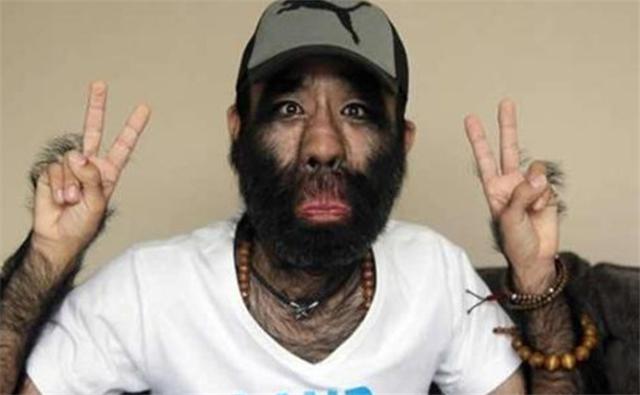 于震寰|“中国毛孩”于震寰:人生坎坷起伏,今43岁终抱得美人归