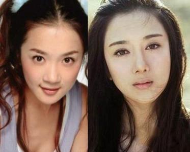 巩俐|十位整容成功前后判若两人的女明星,第五和第八位良心不会痛吗?