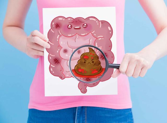 直肠癌@直肠癌是拖出来的,大便四个信号早就提醒,可惜很多人不注意