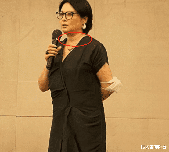 【袁立】46岁袁立怎么了？皮肤松弛变大妈脸，大象腿水桶腰发福好明显