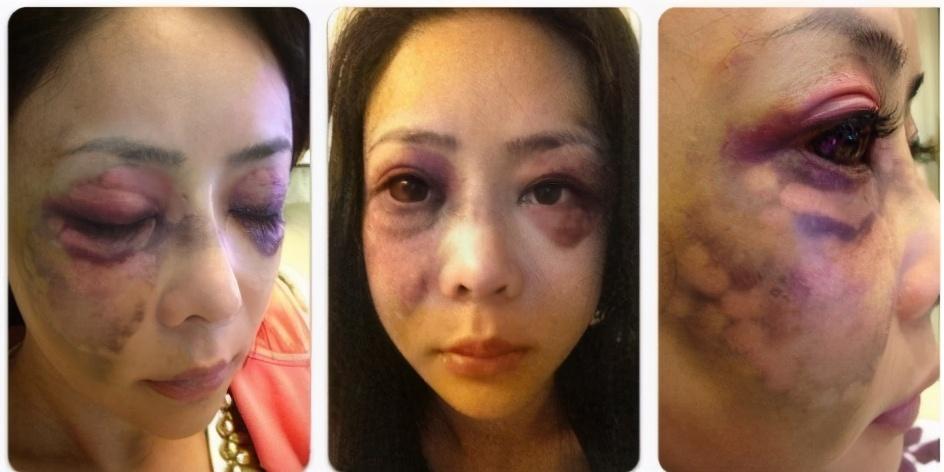 娱乐圈|她是“最惨女星”，被富豪男友按在地上猛打到失忆，法庭上发抖