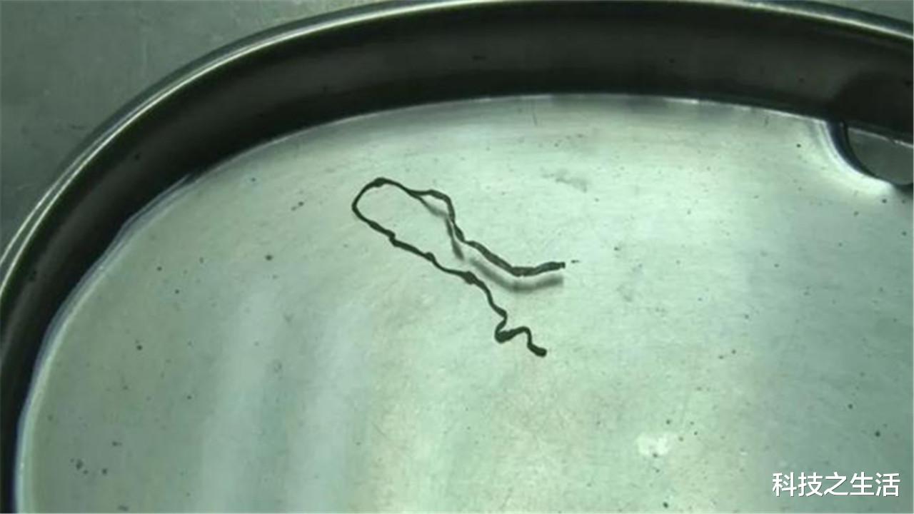 裂头蚴|这些动物不要吃了！这些人有多愚昧，才把寄生虫“请”进身体里！