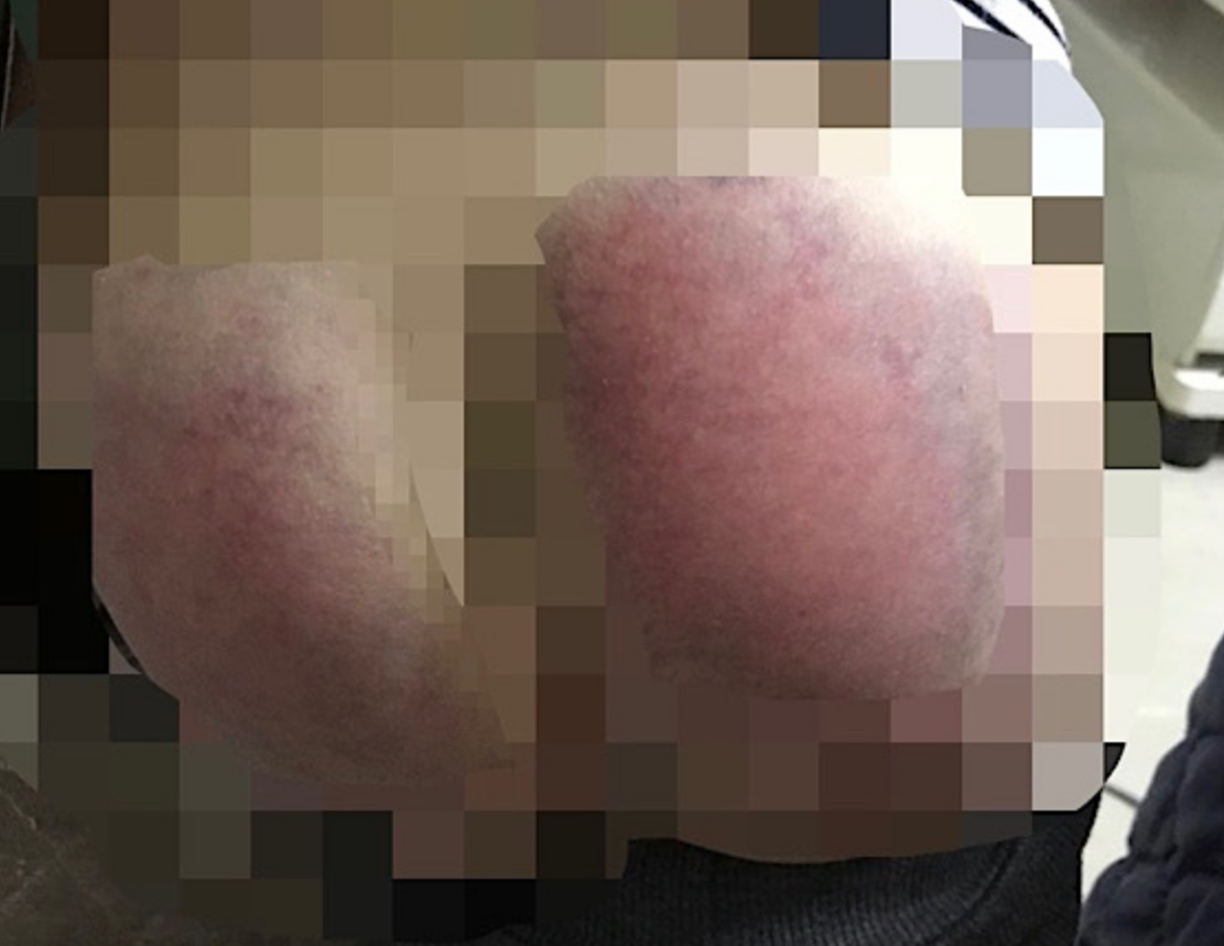 视野新闻周刊 重庆6岁女童因未完成作业被老师殴打住院，事后老师称：我以为板子打不痛