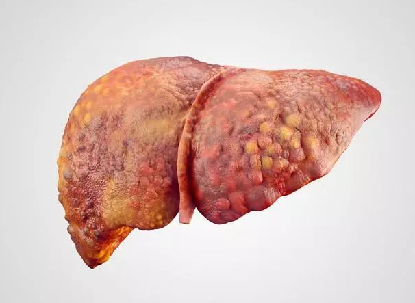 【】饭后身体出现3个迹象，或是肝不好的表现，最好查一下