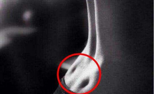 『臀部』仅有3%的女性拥有“圣涡”揭秘女性身体