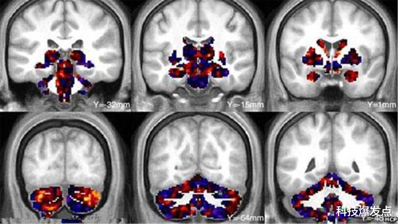 宇航员|人类无法走出地球？宇航员的太空生活，导致身体结构发生变化！