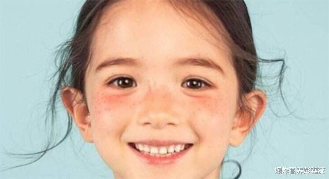 老年斑@为什么有些女性脸上容易长斑？3个原因中，都可以通过自己改善