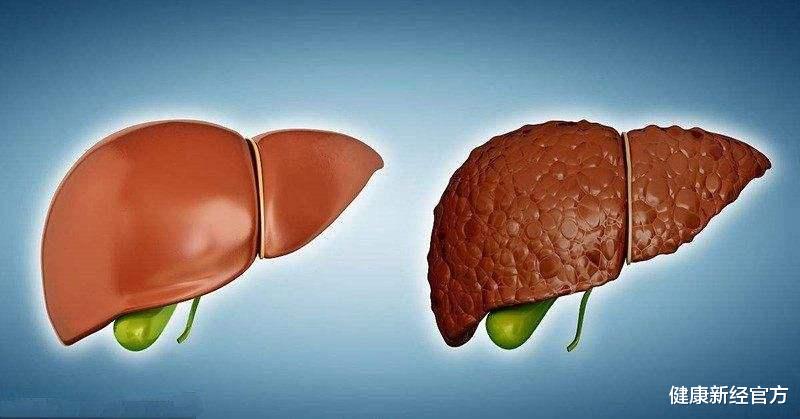 |研究肿瘤60年,90岁院士提醒:这4食物堪称肝癌“元凶”,要远离