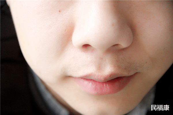 疾病|注意：寿命短的人，身上有3处“发白”，希望你一个没有