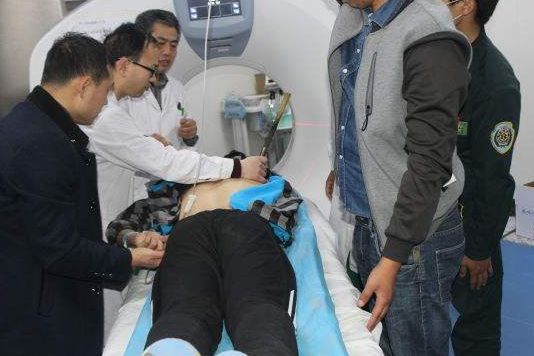 肾衰竭:男性身体2种反应,是肾衰竭的“信号”,很多人当皮肤病