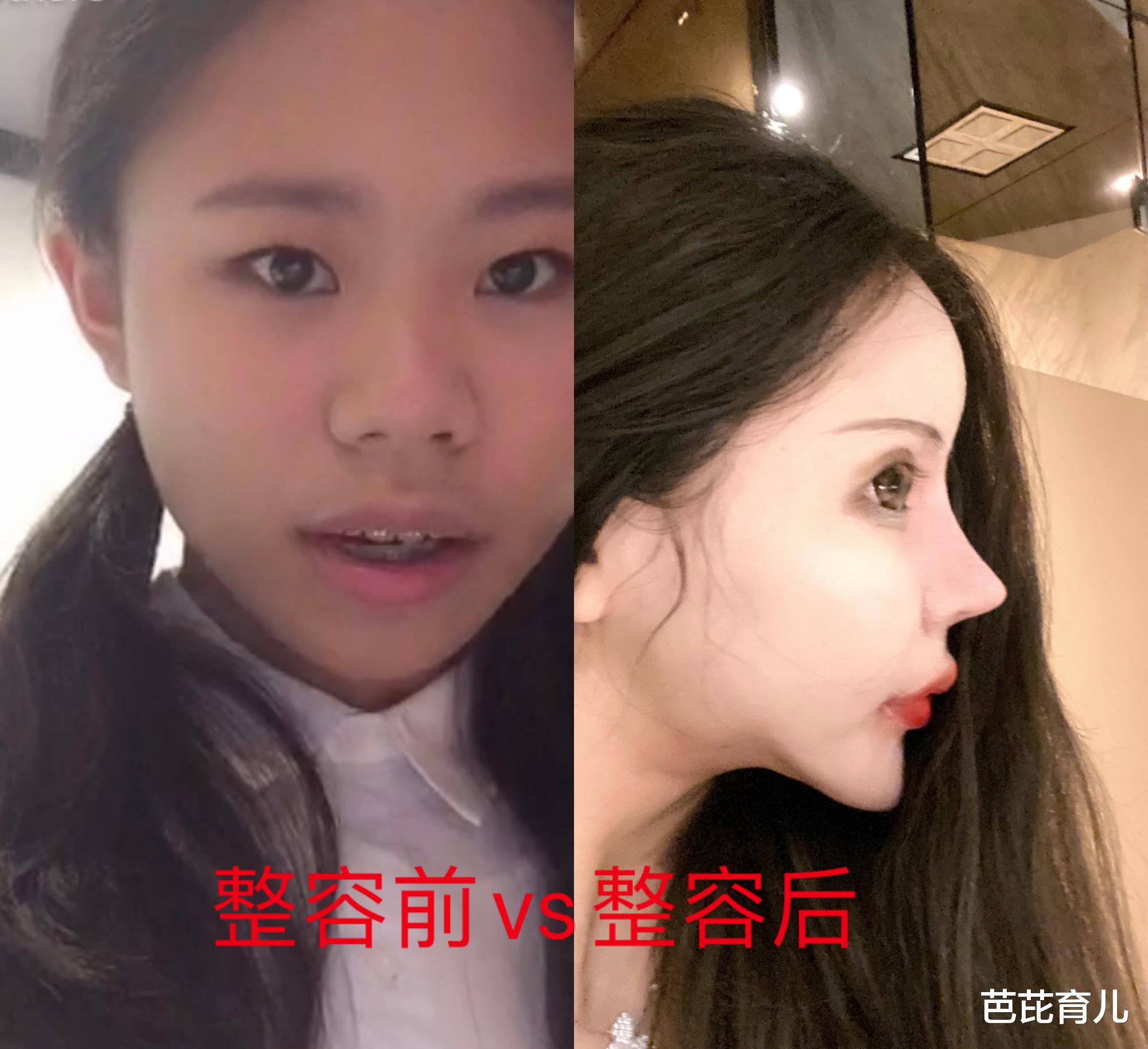 整容：13岁开始整容，砸50万整成“芭比娃娃”，如今16岁她成这般模样