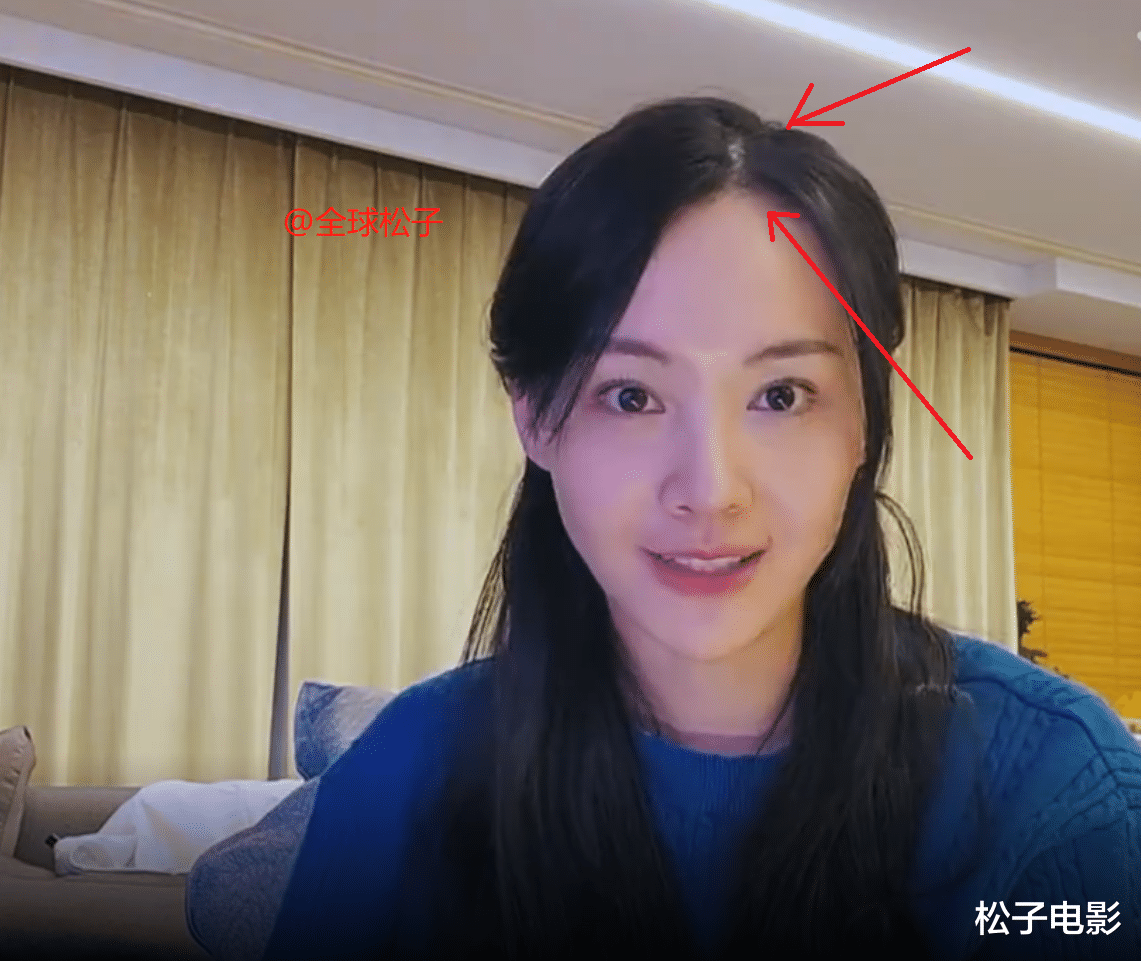 郑爽|郑爽素颜为新综艺录制视频，头发稀疏容貌变化大，让人认不出
